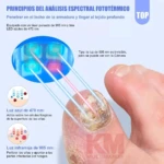 Láser para El Tratamiento de Micosis - Imagen 2