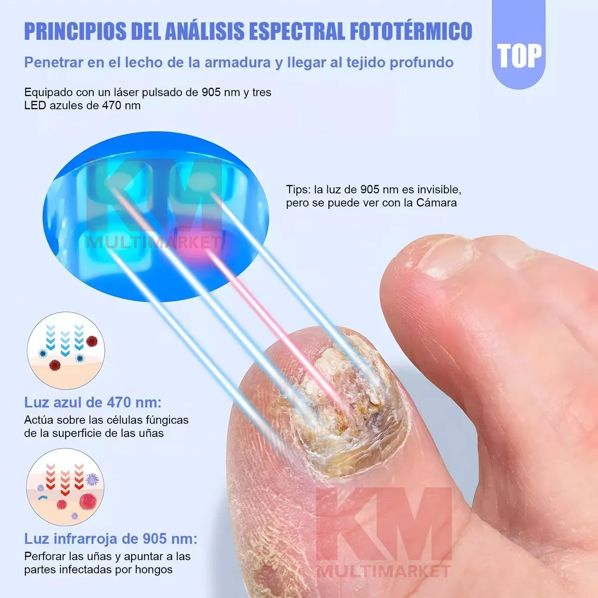 Diagrama técnico del láser fototérmico para micosis de uñas, mostrando haces de luz azul (470 nm) e infrarroja (905 nm) penetrando en la uña infectada, con explicación visual de acción sobre hongos y células.
