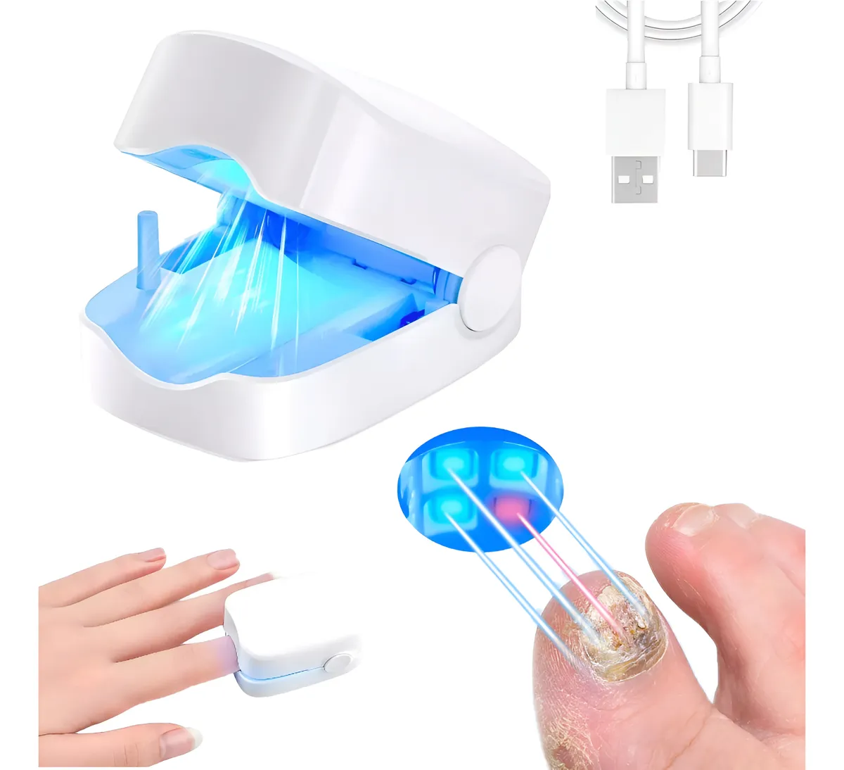Láser para micosis de uñas en blanco, con luz azul visible. Incluye cable USB y muestra aplicación en dedo con uña afectada.