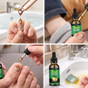 Set x2 Jaysung 7 Days Nail Fungus Treatment
