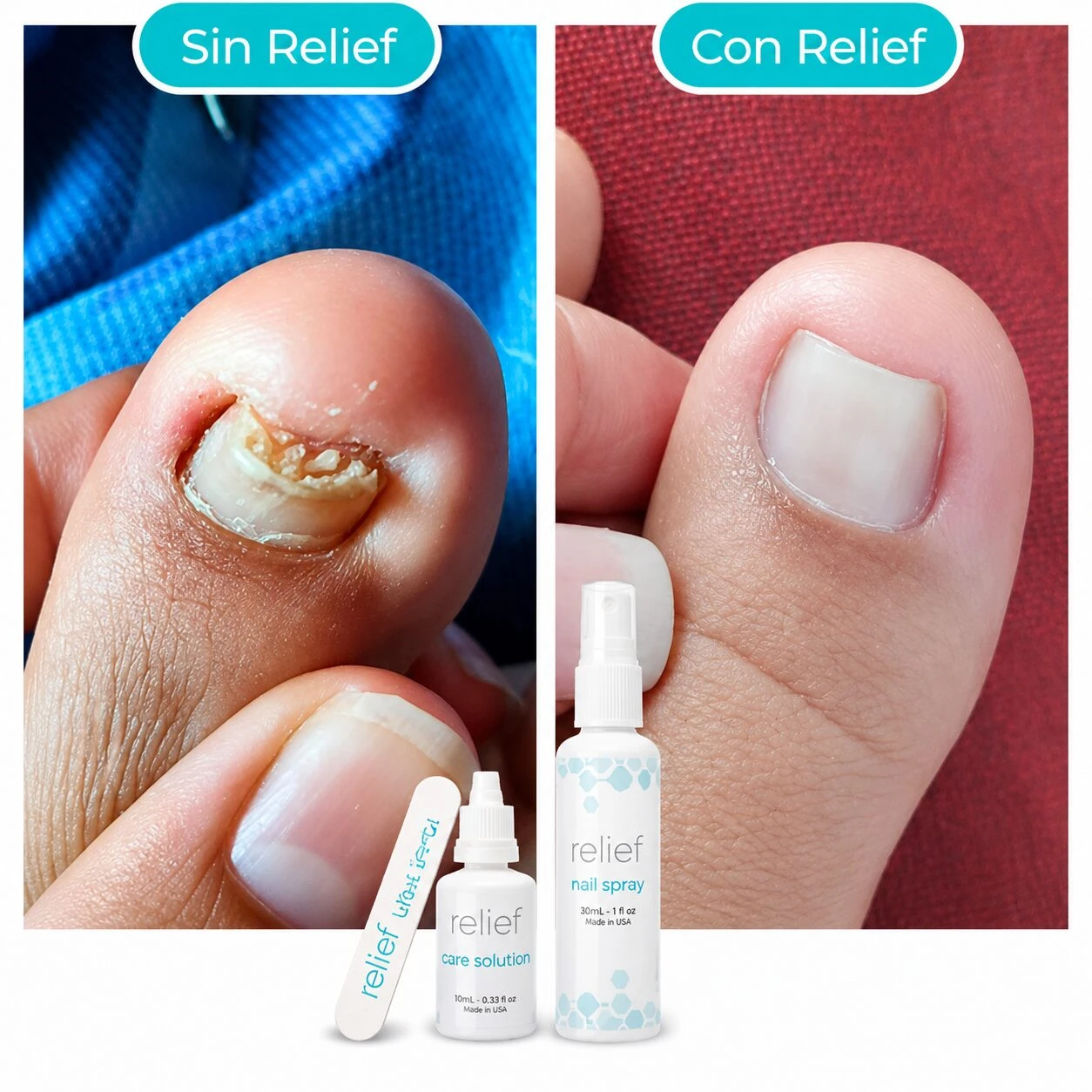 Comparación de uñas: antes y después del tratamiento con spray Relief. A la izquierda, uña dañada por hongos; a la derecha, uña sana y limpia. Incluye botella de spray y dos tubos de solución.
