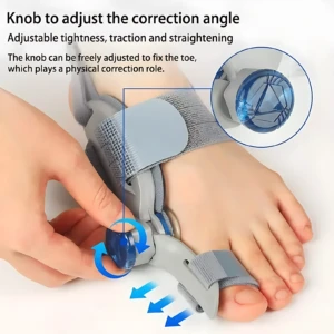 Corrector de juanete gris con perilla azul para ajustar ángulo y tensión, aplicado en pie humano mostrando corrección progresiva del dedo gordo.