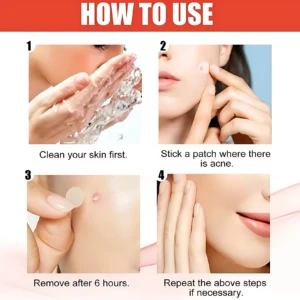 Di Parches Antiacne X144 Pz