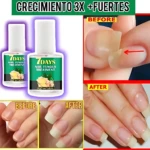 Set de dos frascos de endurecedor de uñas con etiquetas verdes, acompañado de comparativas antes y después mostrando uñas dañadas y recuperadas.
