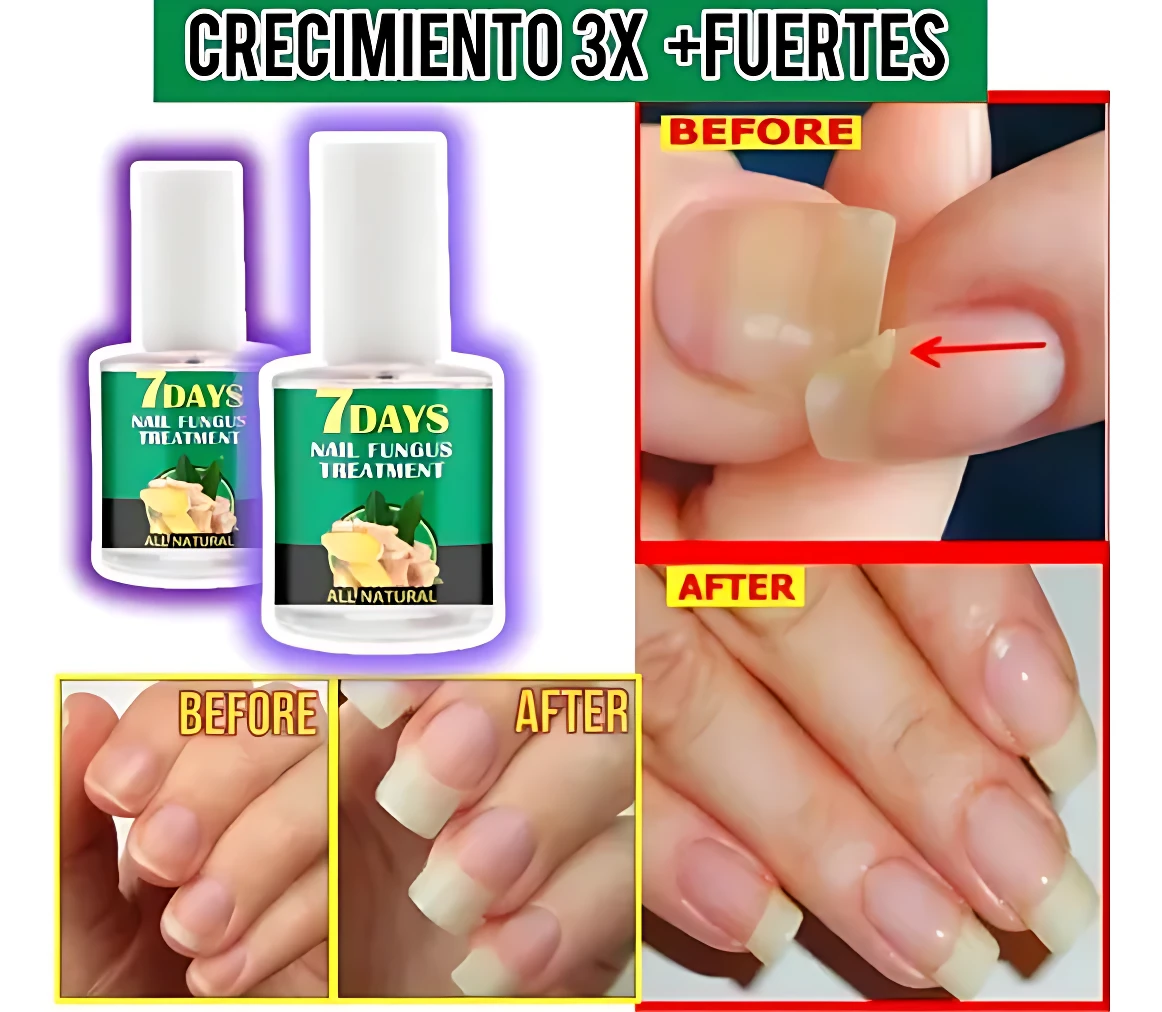 Set de dos frascos de endurecedor de uñas con etiquetas verdes, acompañado de comparativas antes y después mostrando uñas dañadas y recuperadas.