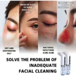 Extractor de puntos negros con agua, dos unidades blancas con depósito transparente, diseñado para limpieza facial profunda y eliminación suave de impurezas.