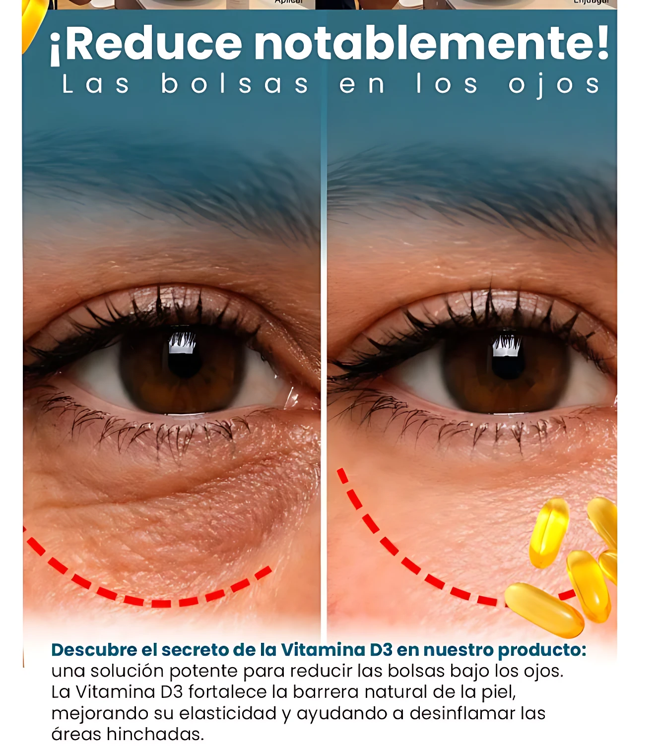 Comparativa de ojos antes y después del uso de Hidropiel Gel de Baño con Aloe y Vitamina E, mostrando reducción de bolsas bajo los ojos.