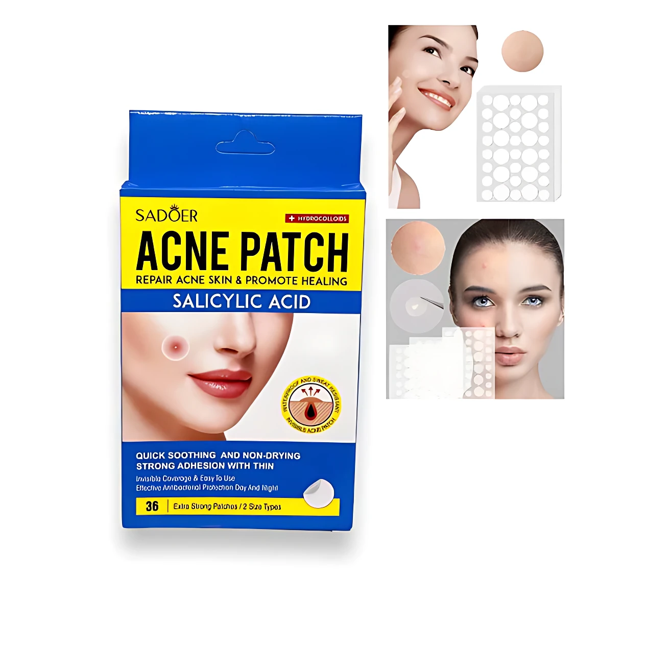 Pack de parches antiacné con ácido salicílico, caja azul y amarilla mostrando rostro con granos y puntos negros. Incluye 36 parches extra fuertes, diseño para uso diario.