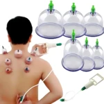 Dispositivo manual de vacuterapia con seis ventosas transparentes y mango blanco, aplicadas en la espalda de una persona para masaje y alivio muscular.