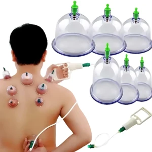 Dispositivo manual de vacuterapia con seis ventosas transparentes y mango blanco, aplicadas en la espalda de una persona para masaje y alivio muscular.