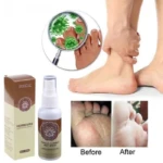 Set x2 Herbacure Herbal Anti Hongos - Imagen 4