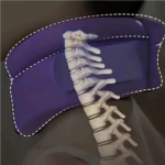 Set x2 Collarín Cervical Ortopédico - Imagen 7