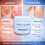 Set x3 Acetato de Aluminio Crema Tópica 60G - Imagen 3