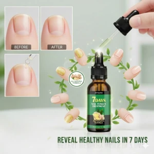 Bote de tratamiento anti hongo para uñas con gotero, etiqueta verde que indica 7 días de uso. Incluye antes y después de uñas sanas y gota aplicada sobre uña.