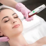 Dr Pen N2 en uso: dispositivo inalámbrico blanco y rojo aplicando tratamiento facial en mujer con guantes rosas.