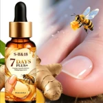 Tratamiento para uñas con veneno de abeja en frasco gotero de 30 ml, con jengibre y abejas, para uñas fuertes en 7 días.