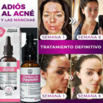 Tónico despigmentante facial y corporal en botella de vidrio ámbar con gotero, junto a caja rosa y fotos de antes y después de tratamiento antimanchas.