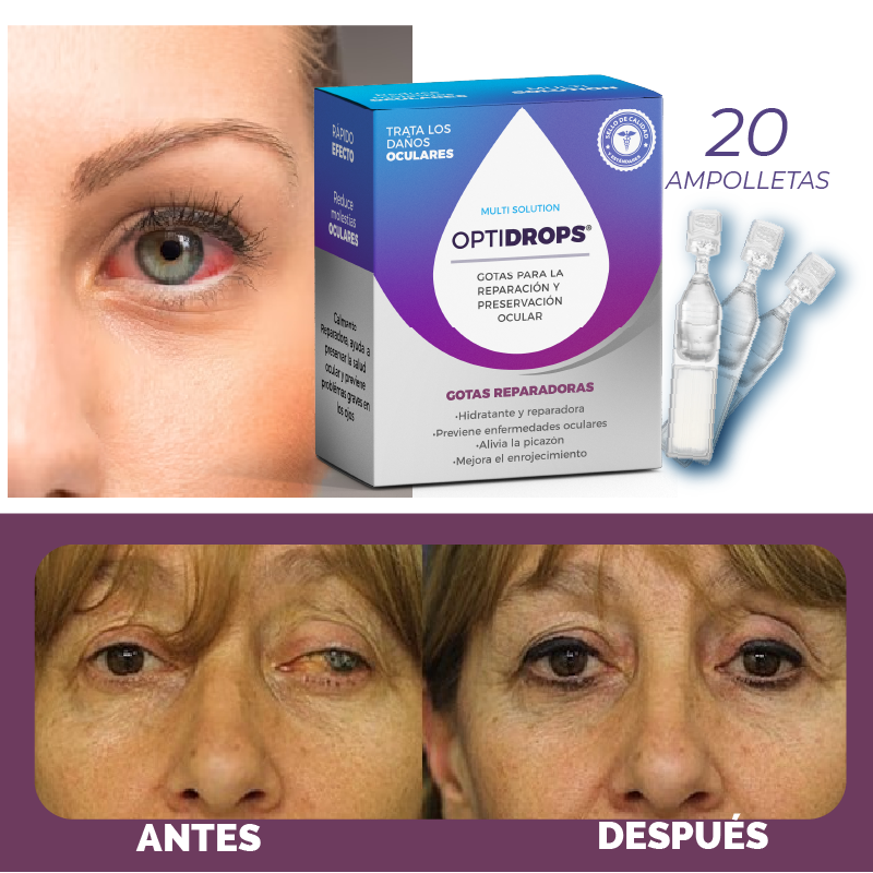 Gotas Reparadoras de Ojos Optidrops - Imagen 2