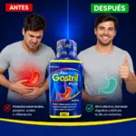 Jarabe Fito Gastril Plus de 360 ml en frasco azul. Comparativa de alivio para acidez e inflamación estomacal, del malestar al bienestar digestivo.