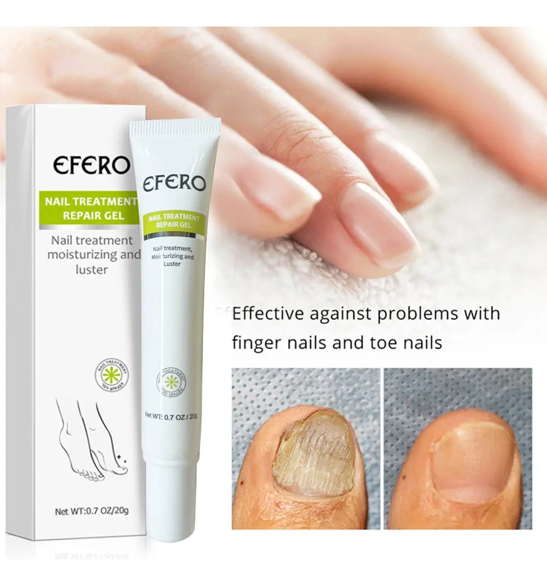 Nail Repair Gel - Elimina Hongos Uñas - Imagen 5