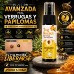 Eliminador de Verrugas - Imagen 3