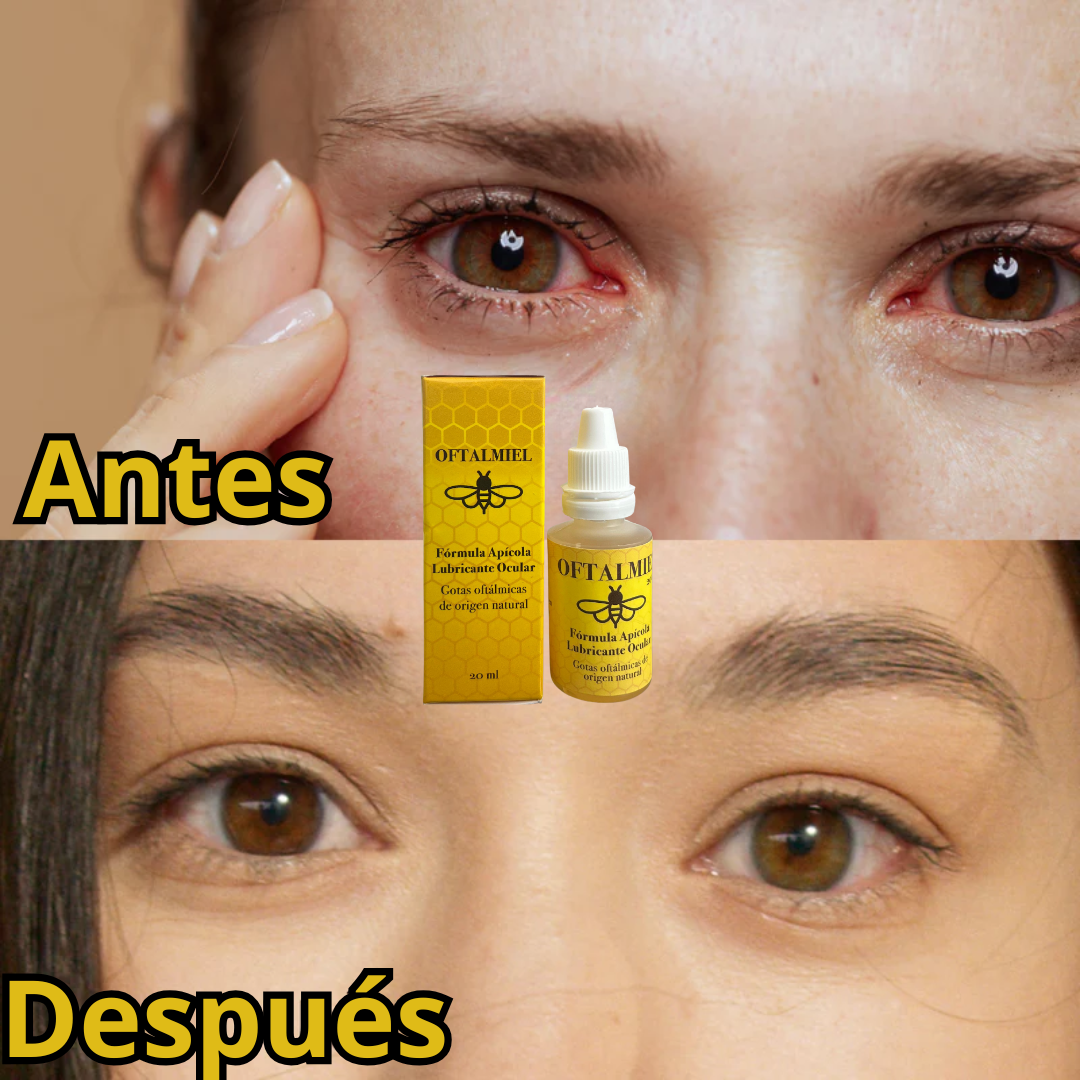 Gotas Oftalmiel Adiós Cataratas - Imagen 5