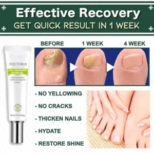 Nail Repair Gel - Elimina Hongos Uñas