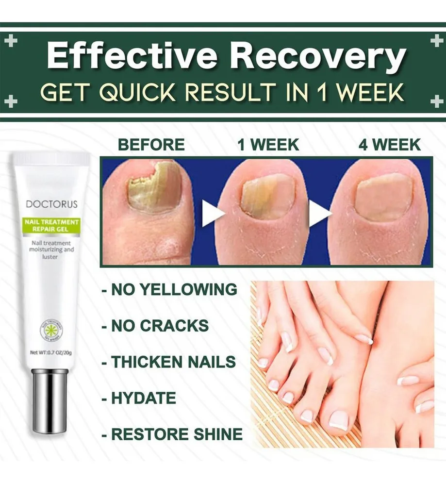 Nail Repair Gel - Elimina Hongos Uñas