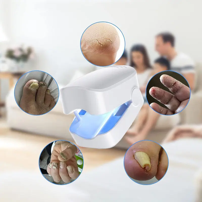 Dispositivo láser blanco compacto con luz azul para hongos en uñas, rodeado de imágenes de pies, manos y talones con micosis y resequedad.