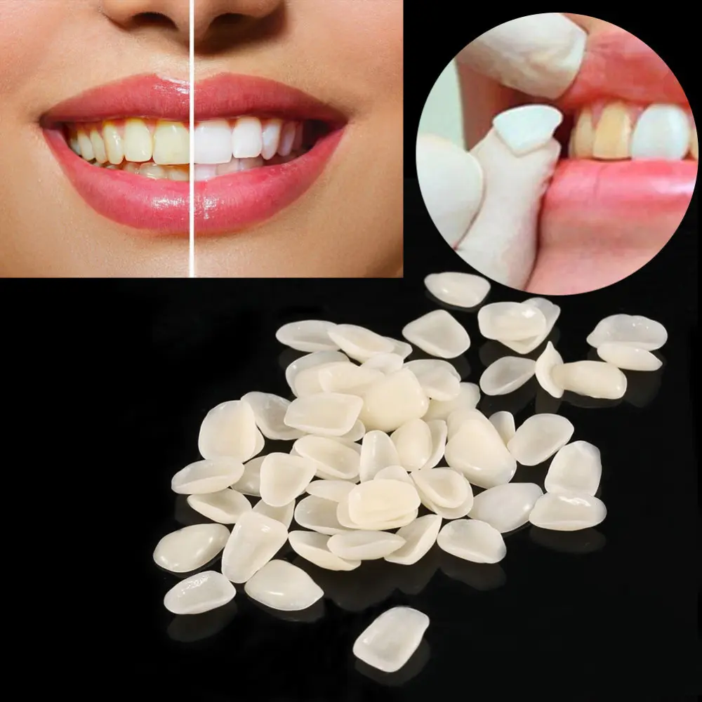 Carillas Dentales Pack X 50 - Imagen 3