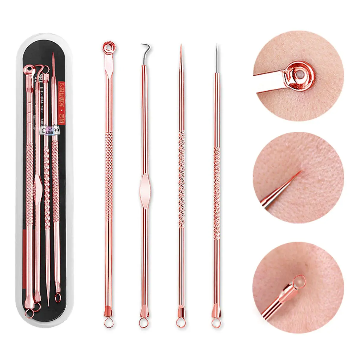 Kit de 4 extractores de acné en acero inoxidable color oro rosa con estuche. Incluye puntas de lazo, gancho y aguja con acercamientos en la piel.