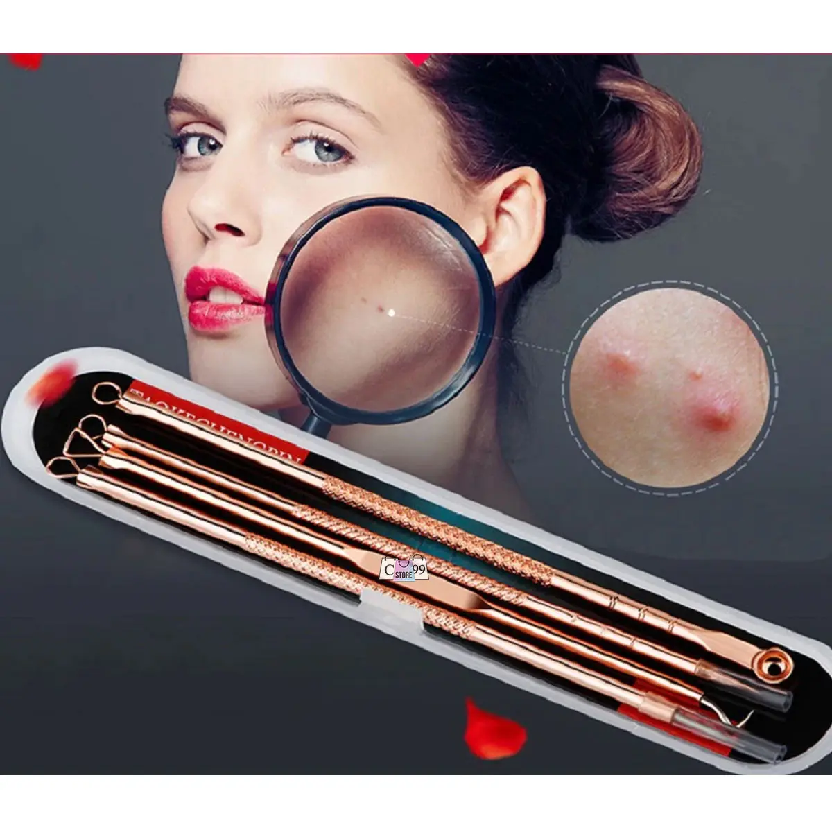 Kit de extractores de acero color oro rosa en estuche, junto a una mujer usando una lupa para identificar impurezas en la piel.