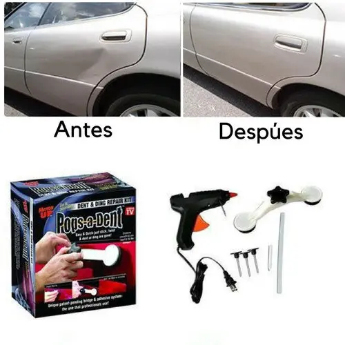 Kit saca golpes para autos Pops A Dent con pistola de silicona, puente arqueado, varillas adhesivas y chupones blancos para reparar la carrocería en casa.