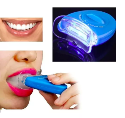 Dispositivo de blanqueamiento dental azul con luz LED y molde transparente en uso, mostrando una sonrisa con dientes blancos y brillantes.