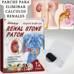 Caja de parches South Moon para cálculos renales con 12 unidades, parches blancos con centro negro y diagramas anatómicos de riñones y cálculos.