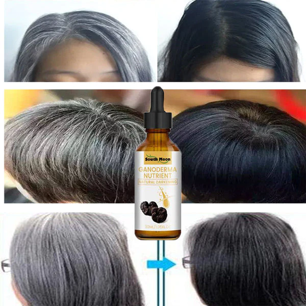 Serum capilar South Moon de 30 ml con extracto de ganoderma para oscurecer canas, mostrando comparativas de cabello antes y después de su aplicación.