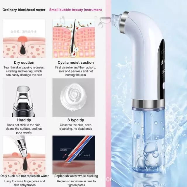 Extractor de puntos negros con agua blanco y azul con depósito transparente, punta en S y succión húmeda para limpieza facial profunda sin irritación