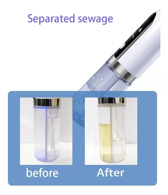 Extractor de puntos negros con agua blanco y transparente, mostrando un depósito dividido con compartimento antes y después de usar.