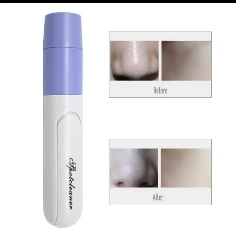 Limpiador de poros blanco con cabezal morado y panel con imágenes de antes y después del tratamiento en nariz y piel.