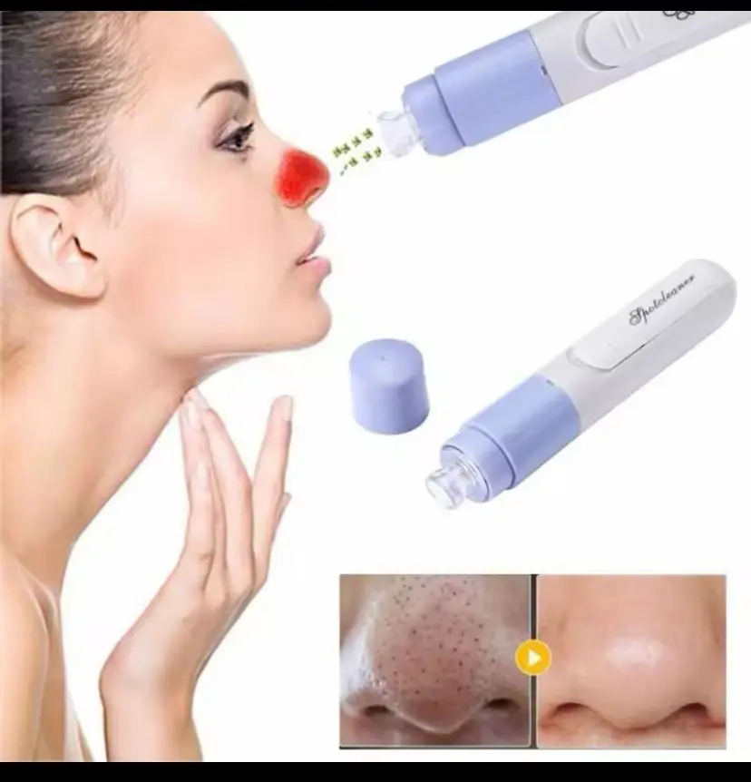 Extractor eléctrico portátil blanco con cabezal morado para limpiar poros y eliminar puntos negros en la nariz.