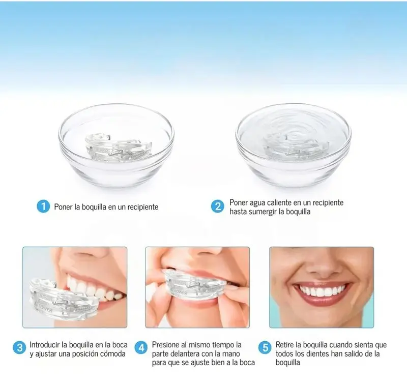 Instrucciones en 5 pasos ilustradas para moldear placa antironquidos transparente sumergiéndola en agua caliente y ajustándola en los dientes