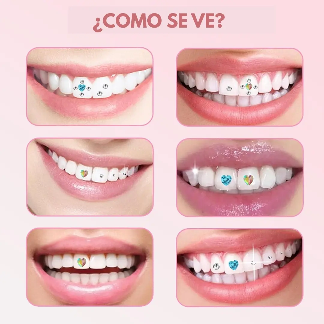 Seis sonrisas con diferentes diseños de cristales dentales brillantes en forma de corazón y circulares aplicados en los dientes.