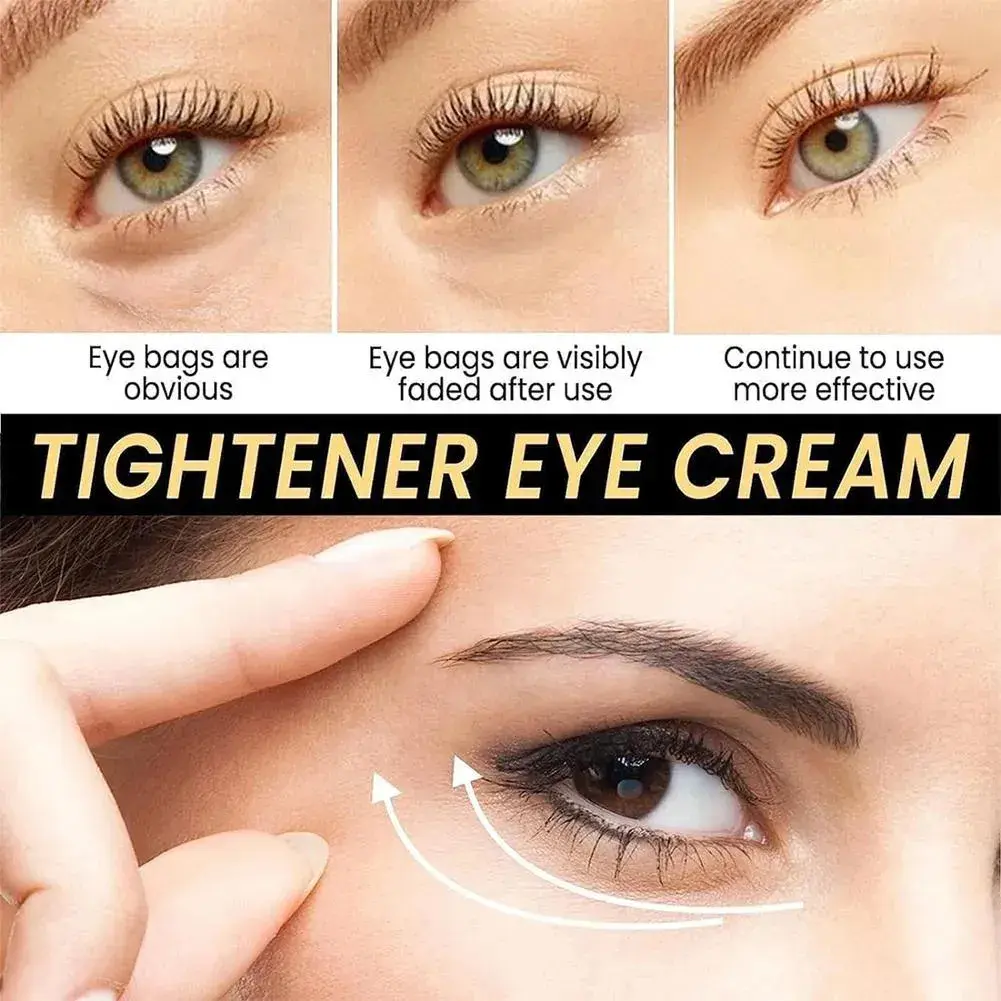 Set x2 Celyn Crema Reafirmante Contorno de Ojos - Atenúa bolsas y ojeras en tres minutos - Imagen 2