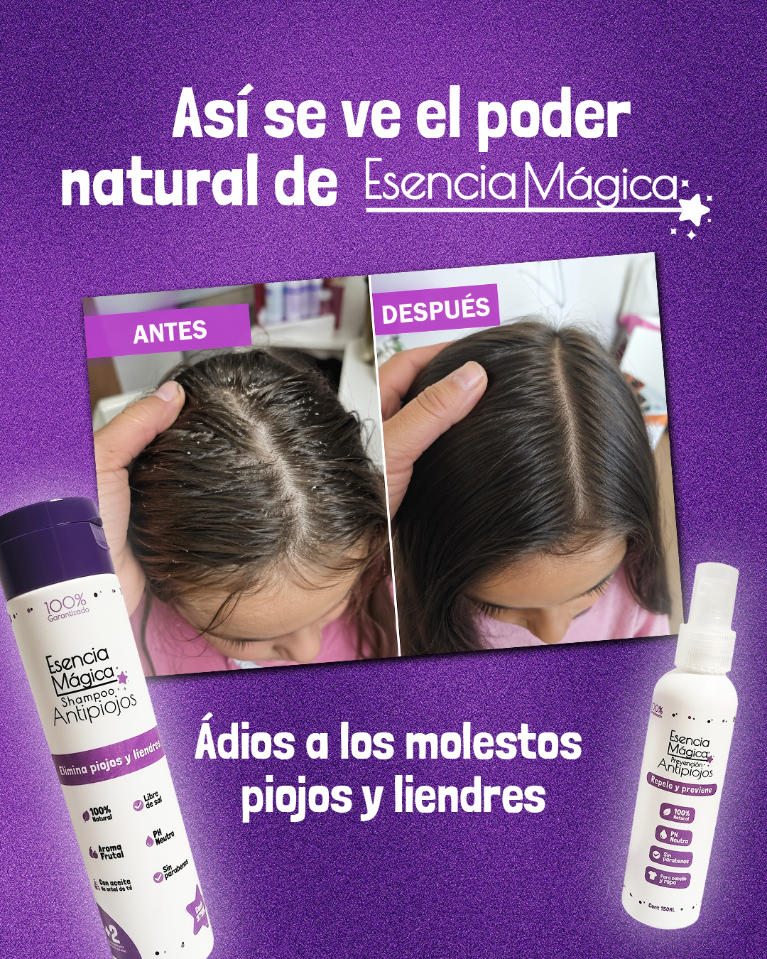 Kit antipiojos con shampoo, spray repelente y peine. Antes y después de uso capilar para eliminar piojos y liendres en cabello escolar.