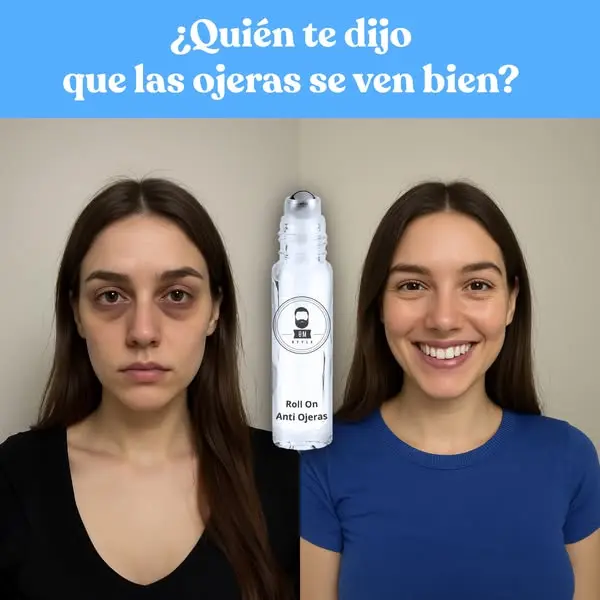 Set x3 Roll On Anti Ojeras 8 ml con Obsequio - Reduce bolsas y revitaliza tu mirada - Imagen 2