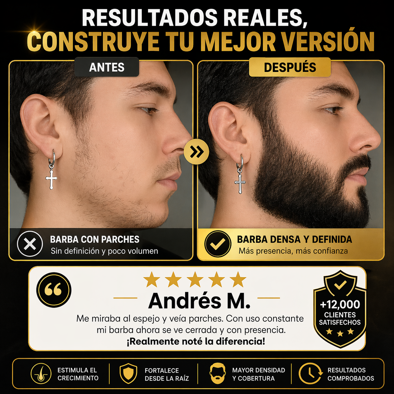 Bálsamo activador de barba antes y después en hombre, mostrando mayor densidad, cobertura y crecimiento uniforme desde la raíz.