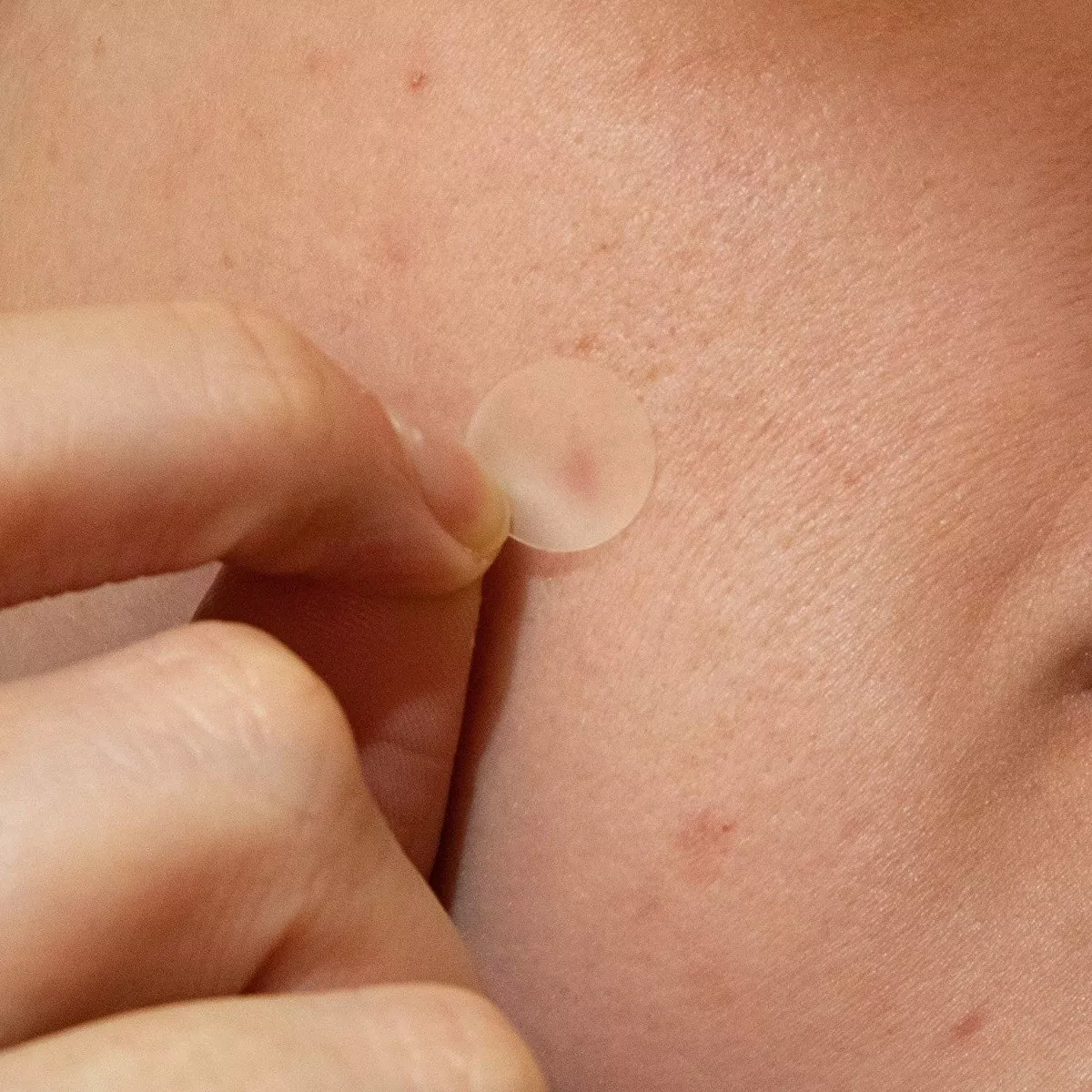 Parches Hidrocoloides para Imperfecciones PanOxyl 40 Unidades - Absorben el exceso de grasa y protegen la piel