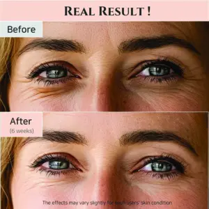 Beauty Of Joseon Revive Eye 30Ml
