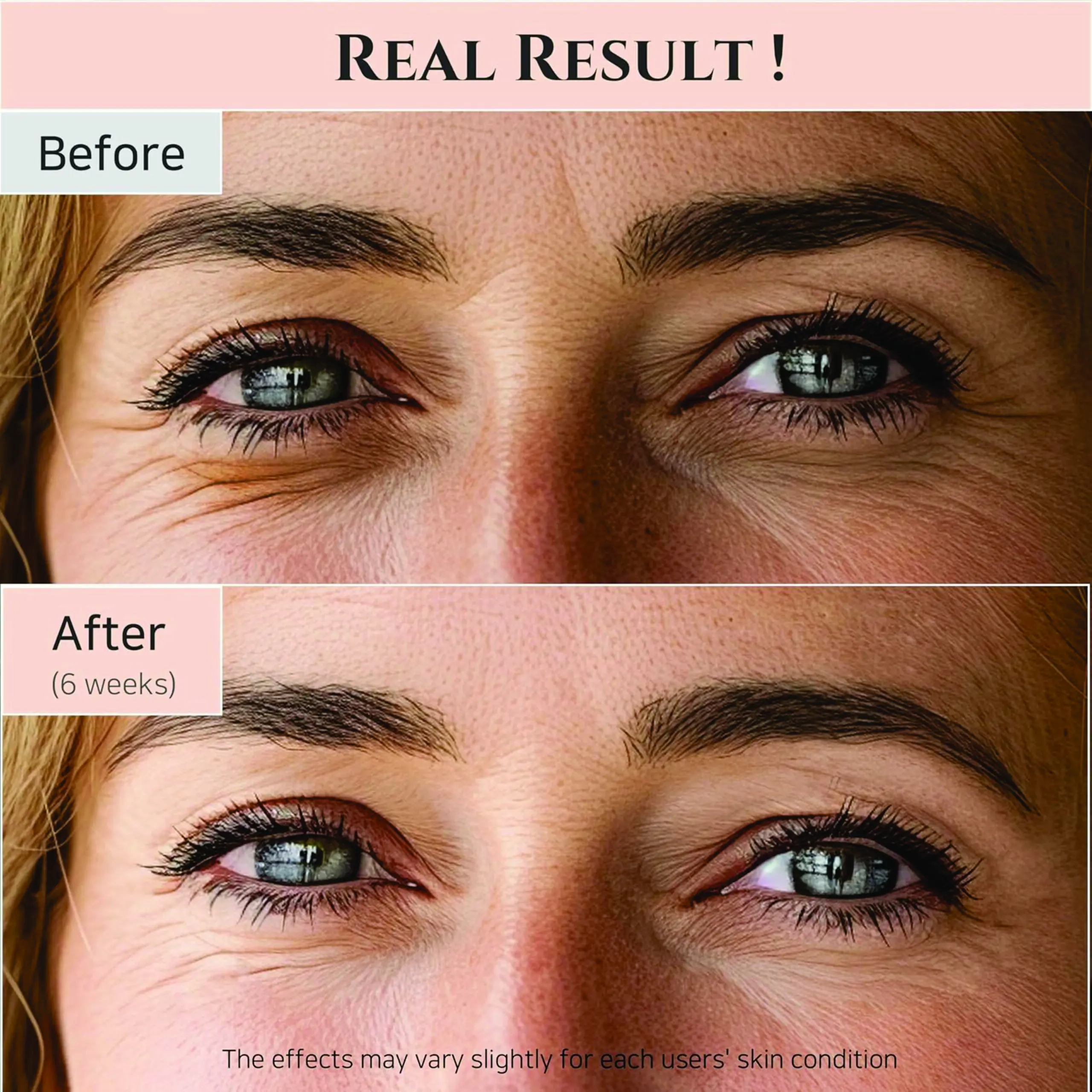 Beauty Of Joseon Revive Eye 30Ml