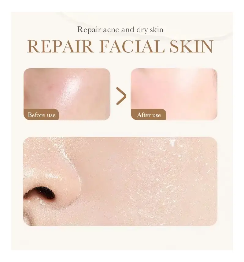Set x2 ampollas liofilizadas de niacinamida y vitamina C para reparar piel seca con antes y después facial.